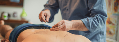 Acupuncture